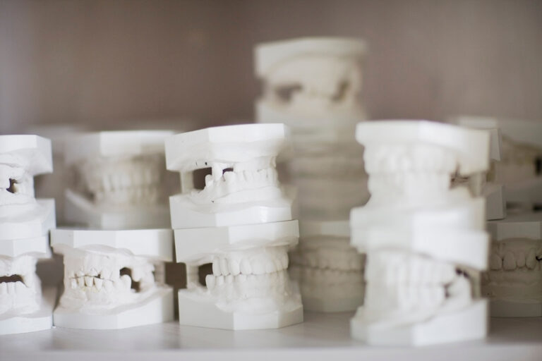 plaster models of teeth 2022 03 04 01 46 56 utc 1